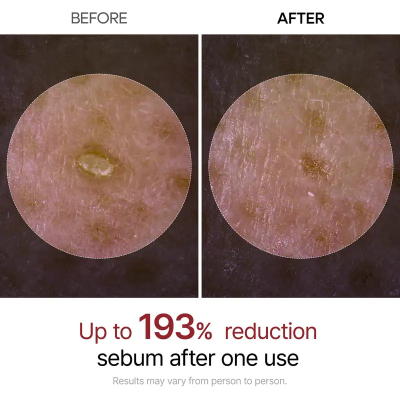 VioletGlam Final 3 Hours: 73% OFF 🔥 Dr.Melexin Peel Shot Glow Rice Ampoule Duo