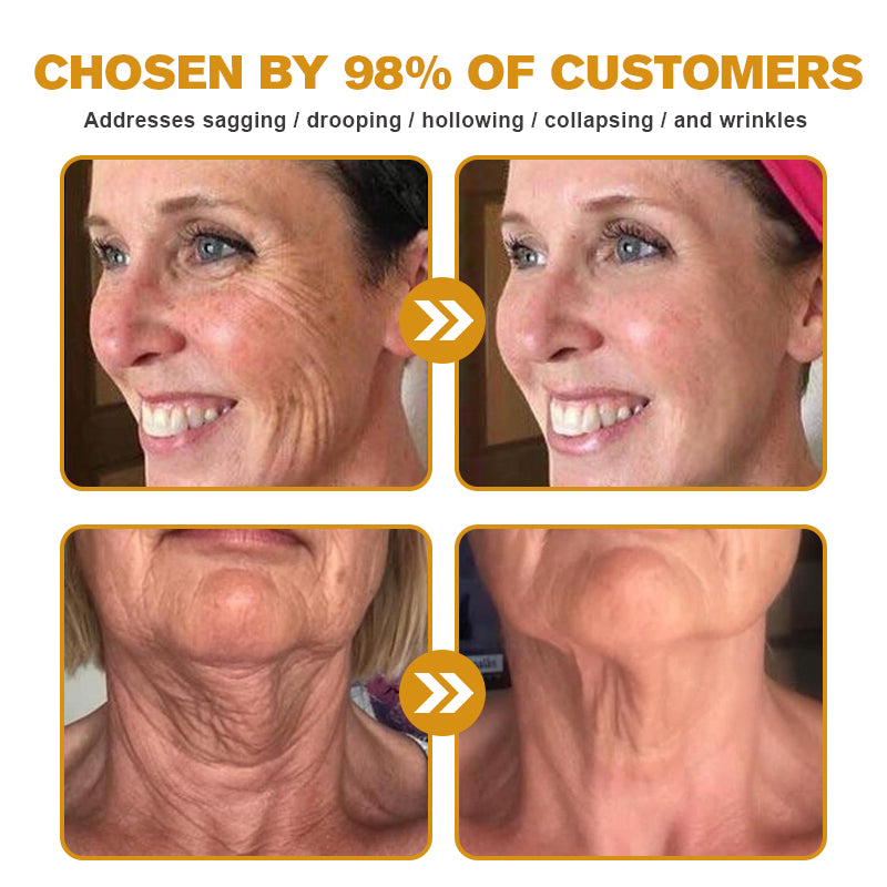 (šMade and Shipped from USAā
) šµšššššĀ® Botox Bee Venom Wrinkle Removal Cream- LAST DAY 50% OFFšæšæ