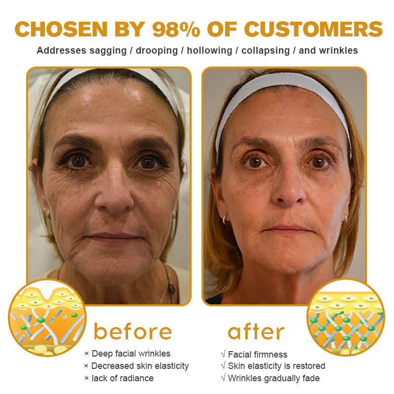 (šMade and Shipped from USAā
) šµšššššĀ® Botox Bee Venom Wrinkle Removal Cream- LAST DAY 50% OFFšæšæ