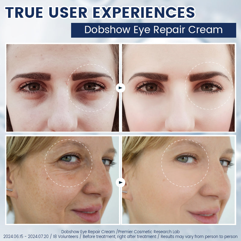 Fubsta® α-Arbutin 2%+caffeine Eye Repair Cream 🍒☕️