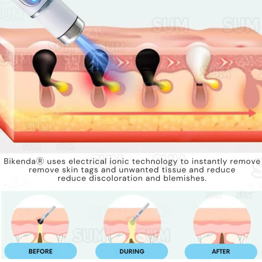 ✨Bikenda®Non-Invasive Skin Imperfection Removal Pen✨(safe)