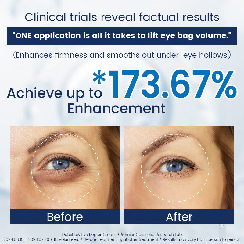 Fubsta® α-Arbutin 2%+caffeine Eye Repair Cream 🍒☕️