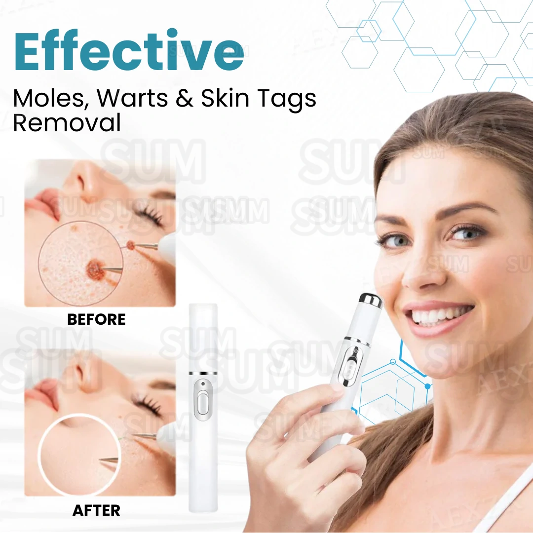✨Bikenda®Non-Invasive Skin Imperfection Removal Pen✨(safe)