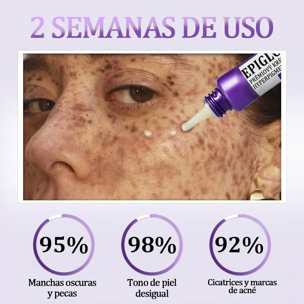 💜Fubsta® EPIGLOW MelanEX crema premium contra la hiperpigmentación | ✅Aprobado por la FDA