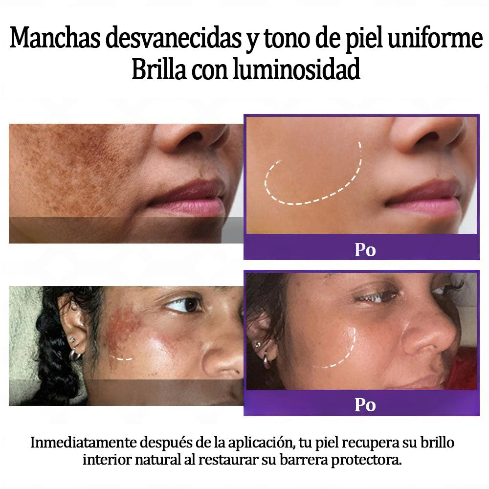 💜Fubsta® EPIGLOW MelanEX crema premium contra la hiperpigmentación | ✅Aprobado por la FDA