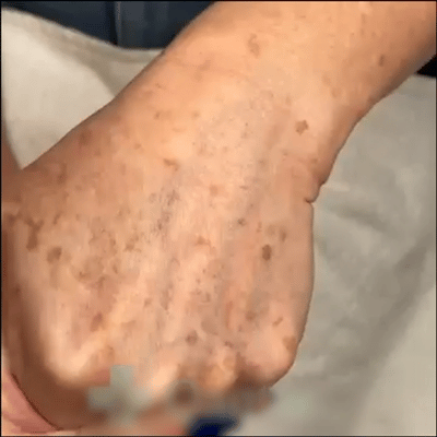 šFubstaĀ® EPIGLOW MelanEX premium cream against hyperpigmentation | ā
Complies with US high standard cosmetic regulations