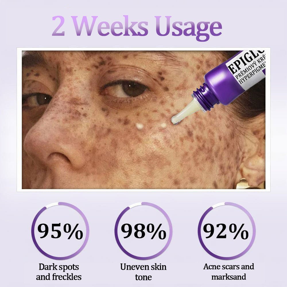 šFubstaĀ® EPIGLOW MelanEX premium cream against hyperpigmentation | ā
Complies with US high standard cosmetic regulations