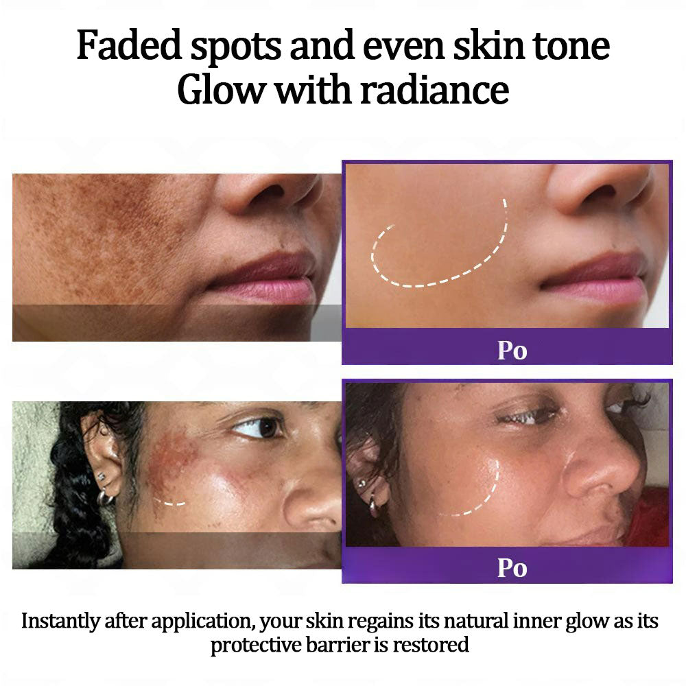 šFubstaĀ® EPIGLOW MelanEX premium cream against hyperpigmentation | ā
Complies with US high standard cosmetic regulations