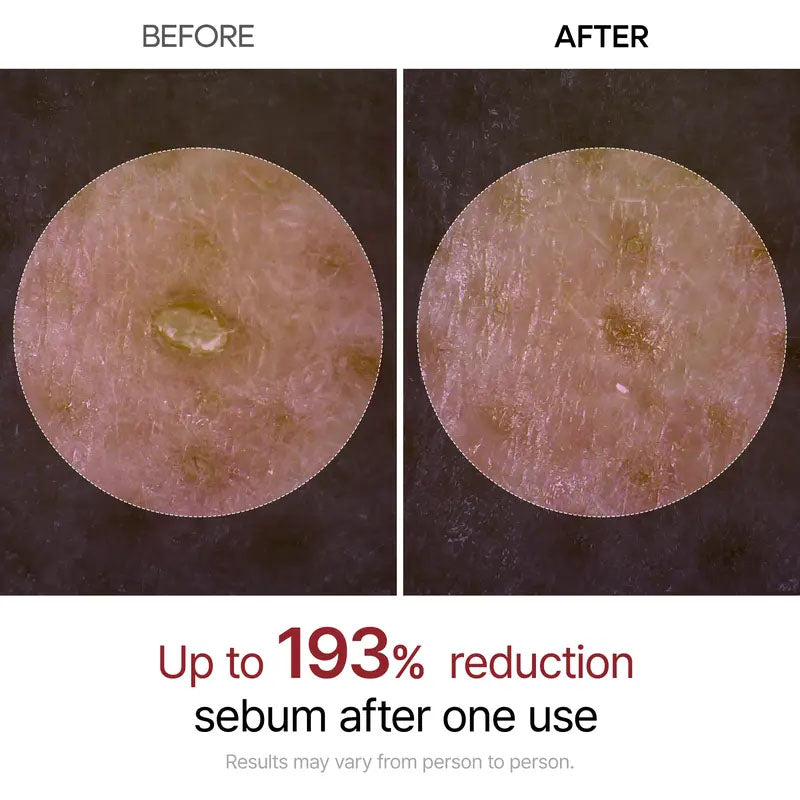 [Dr.Melexin Official] Peel Shot Glow Rice Ampoule Duo - Serums for Brightening, Exfoliating, and Moisturizing - Suitable for All Skin Types