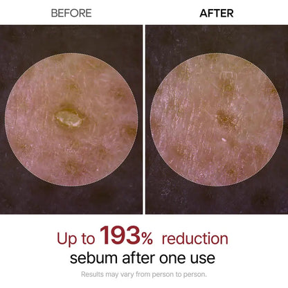 [Dr.Melexin Official] Peel Shot Glow Rice Ampoule Duo - Serums for Brightening, Exfoliating, and Moisturizing - Suitable for All Skin Types