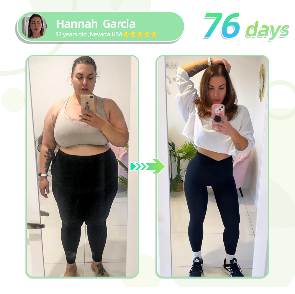 [🚀Regain your figure in 7 days🚀] 💯Tnnedey® SMGT-GLP-1 Nano Microneedle Patch（Painless, long-lasting, addressing diabetes, obesity, and cardiovascular diseases）