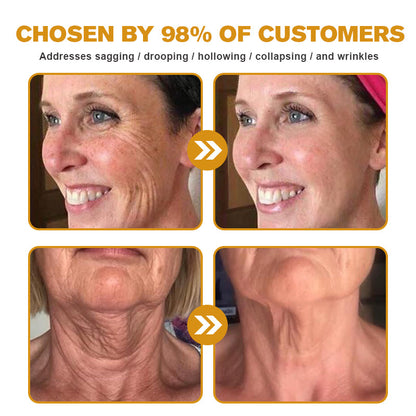 (🎁Made and Shipped from USA✅) 𝙵𝚞𝚋𝚜𝚝𝚊® Botox Bee Venom Wrinkle Removal Cream- LAST DAY 50% OFF🌿🌿