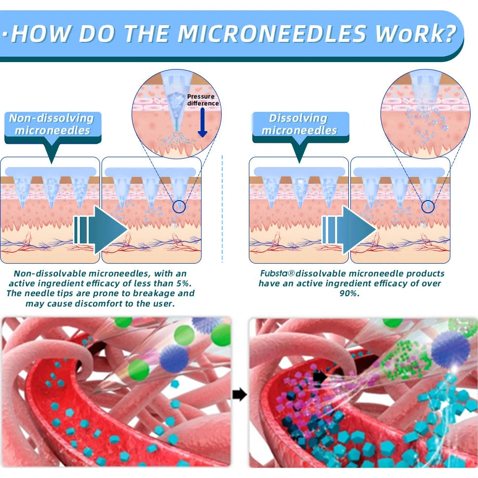 【Fubsta® Official Store】 NIDDK-Tirzepatide Nano Microneedle Patch （Zero Pain, 24/7 Release | Lose 20lbs FAST | 90% Sugar Drop | ）