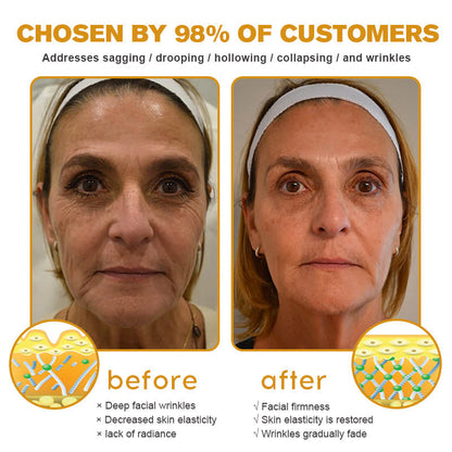 (🎁Made and Shipped from USA✅) 𝙵𝚞𝚋𝚜𝚝𝚊® Botox Bee Venom Wrinkle Removal Cream- LAST DAY 50% OFF🌿🌿