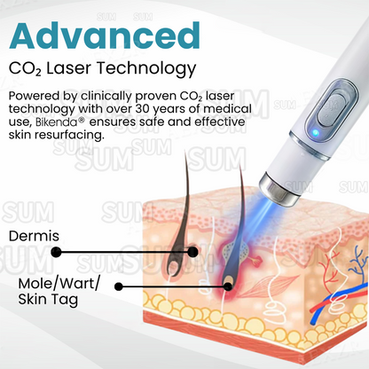 ✨Bikenda®Non-Invasive Skin Imperfection Removal Pen✨(safe)