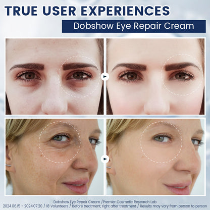 Fubsta® α-Arbutin 2%+caffeine Eye Repair Cream 🍒☕️