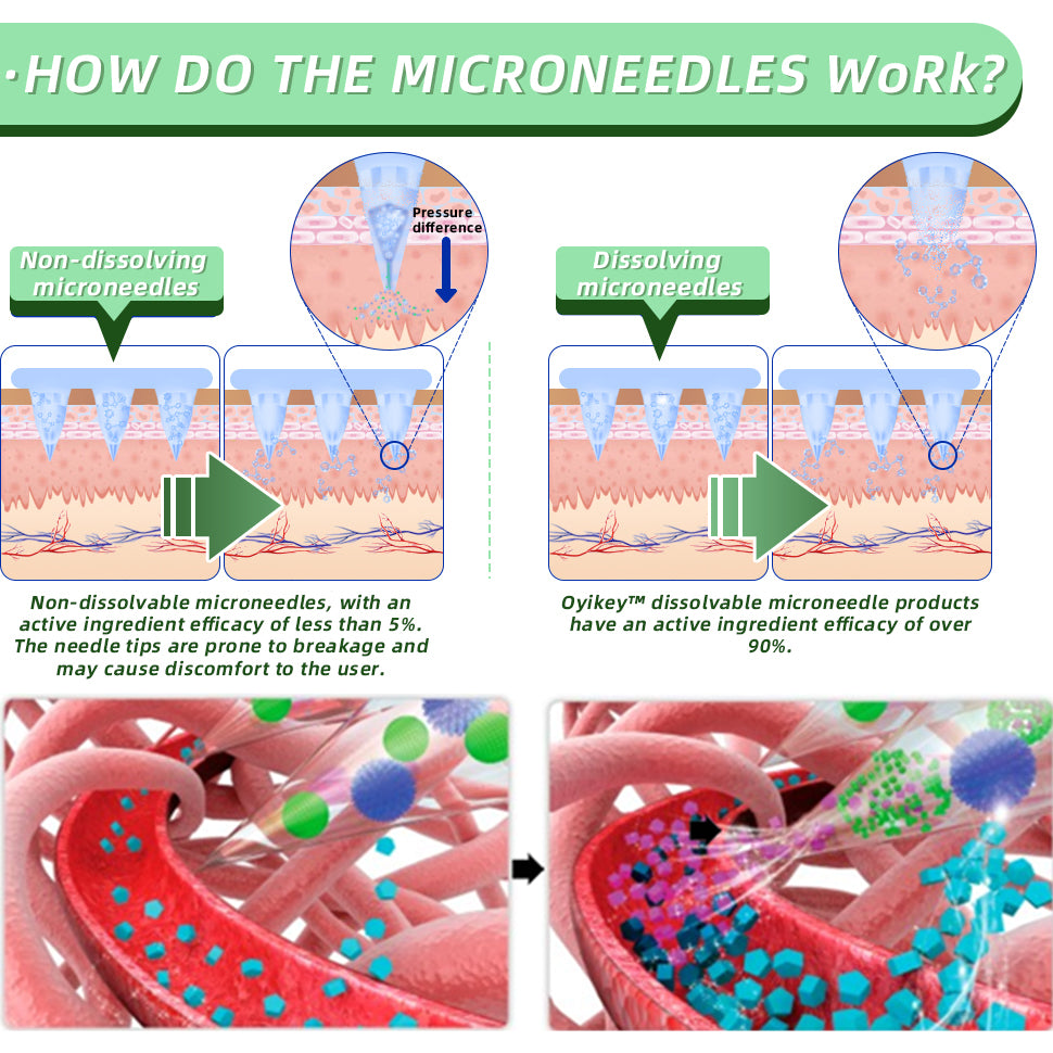 [🚀Regain your figure in 7 days🚀] 💯Tnnedey® SMGT-GLP-1 Nano Microneedle Patch（Painless, long-lasting, addressing diabetes, obesity, and cardiovascular diseases）