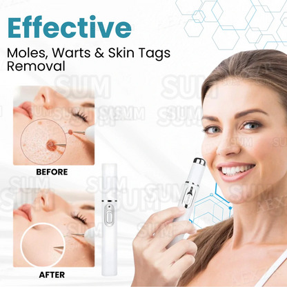 ✨Bikenda®Non-Invasive Skin Imperfection Removal Pen✨(safe)