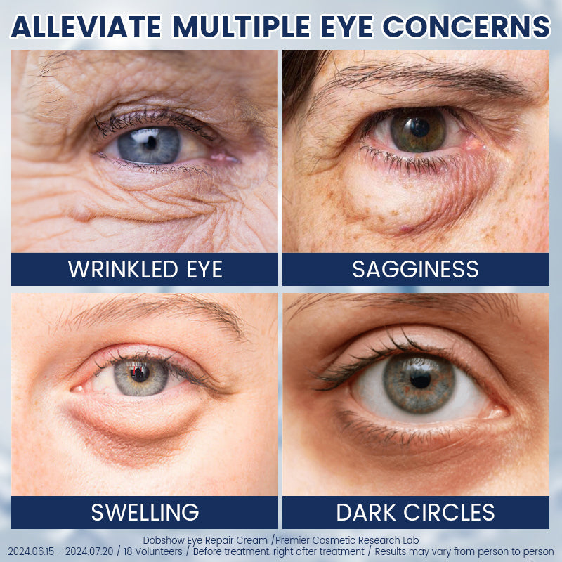 Fubsta® α-Arbutin 2%+caffeine Eye Repair Cream 🍒☕️