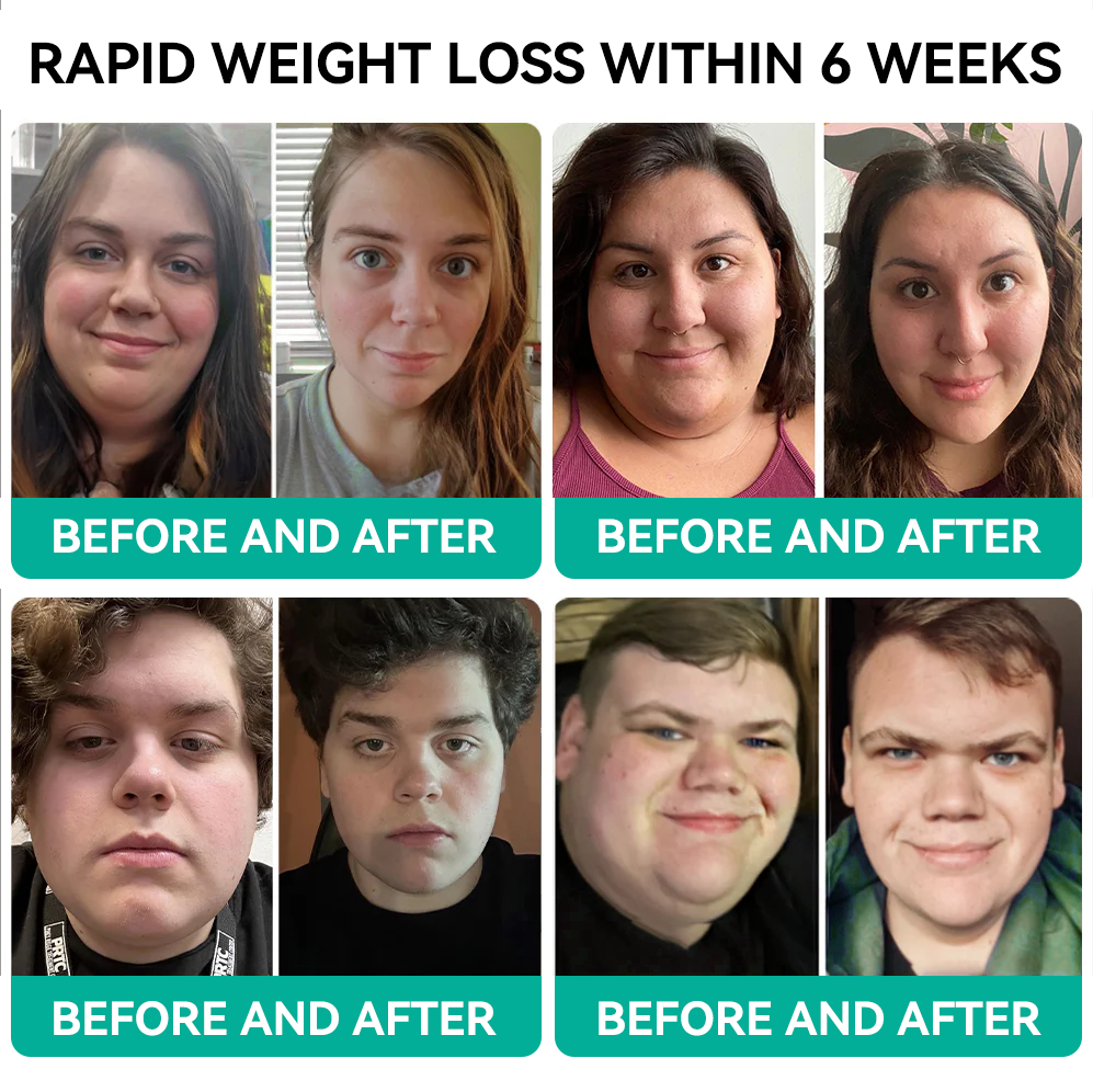 [See results in 7 days]🌍Tnnedey® 𝑺𝑴𝑮𝑻-𝑮𝑳𝑷-1 𝑵𝒂𝒏𝒐 𝑴𝒊𝒄𝒓𝒐𝒏𝒆𝒆𝒅𝒍𝒆 𝑷𝒂𝒕𝒄𝒉（Painless, long-lasting, addressing diabetes, obesity, and cardiovascular diseases）