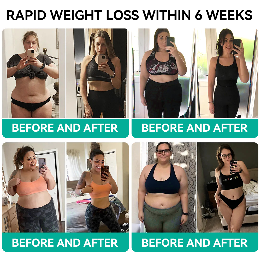 [See results in 7 days]🌍Tnnedey® 𝑺𝑴𝑮𝑻-𝑮𝑳𝑷-1 𝑵𝒂𝒏𝒐 𝑴𝒊𝒄𝒓𝒐𝒏𝒆𝒆𝒅𝒍𝒆 𝑷𝒂𝒕𝒄𝒉（Painless, long-lasting, addressing diabetes, obesity, and cardiovascular diseases）