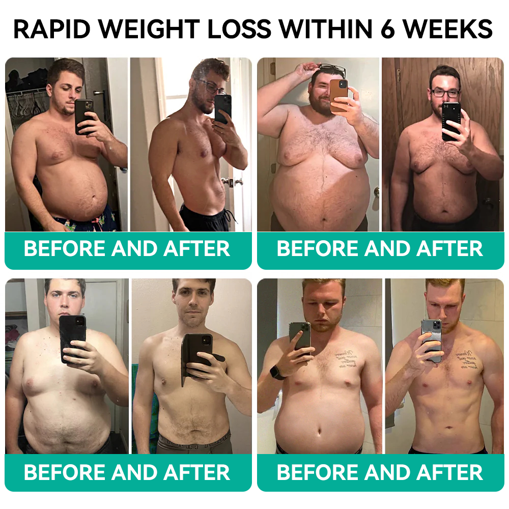[See results in 7 days]🌍Tnnedey® 𝑺𝑴𝑮𝑻-𝑮𝑳𝑷-1 𝑵𝒂𝒏𝒐 𝑴𝒊𝒄𝒓𝒐𝒏𝒆𝒆𝒅𝒍𝒆 𝑷𝒂𝒕𝒄𝒉（Painless, long-lasting, addressing diabetes, obesity, and cardiovascular diseases）