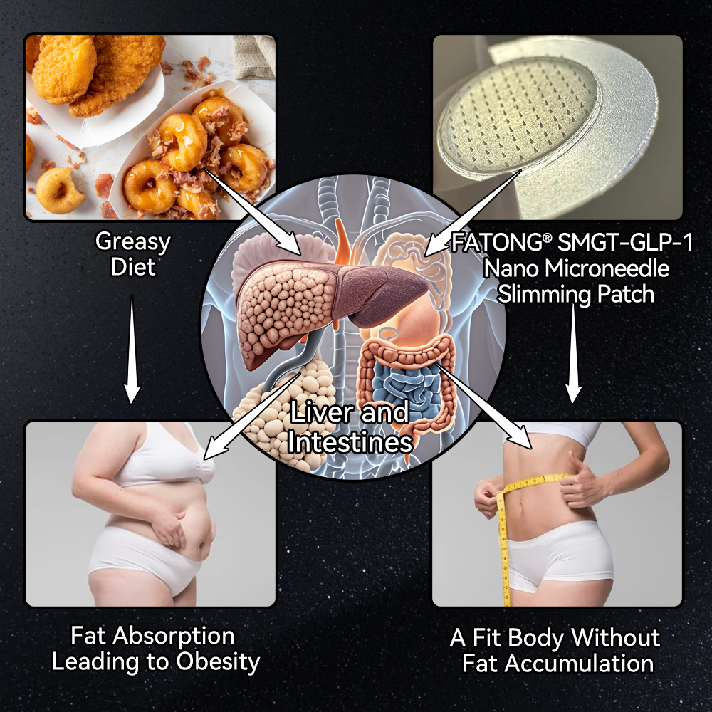 [See results in 7 days]🌍Tnnedey® 𝑺𝑴𝑮𝑻-𝑮𝑳𝑷-1 𝑵𝒂𝒏𝒐 𝑴𝒊𝒄𝒓𝒐𝒏𝒆𝒆𝒅𝒍𝒆 𝑷𝒂𝒕𝒄𝒉（Painless, long-lasting, addressing diabetes, obesity, and cardiovascular diseases）