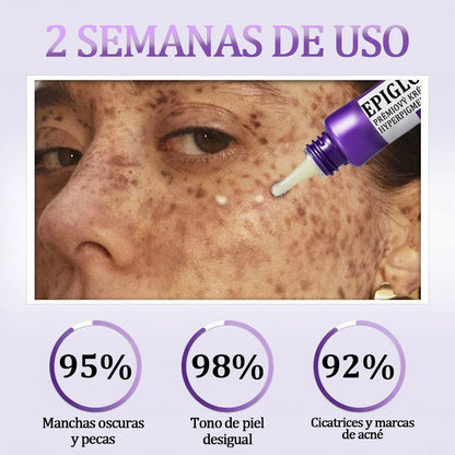🟣Fubsta® EPIGLOW MelanEX crema premium contra la hiperpigmentación | ✅Aprobado por la FDA